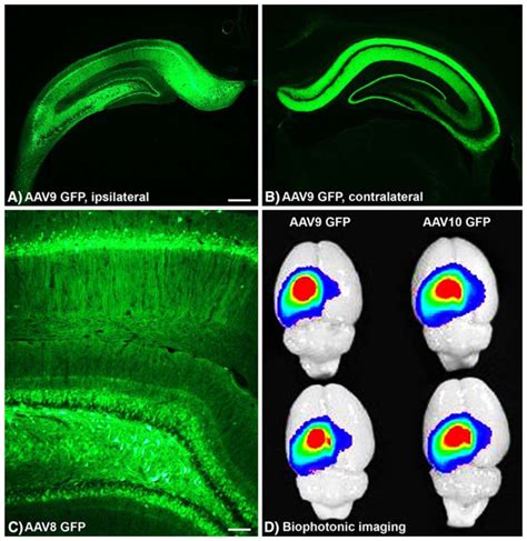 Widespread Expression Of Recombinant Green Fluorescent Protein GFP In