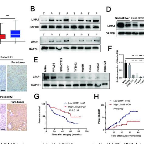 Lima1 Suppresses Hcc Cell Malignant Phenotypes In Vitro A Cck 8 B Download Scientific