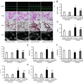 FLNA deficiency in smooth muscle cells alleviates pulmonary arterial ... 