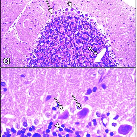 A Photomicrograph Of A Paraffin Section Of The Cerebellum Of A Control Download Scientific