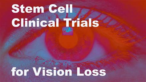 Eyeing Stem Cell Therapies For Vision Loss Youtube