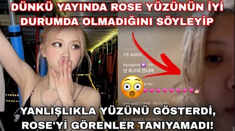 Dünkü yayında Rose yüzünün iyi durumda olmadığını söyleyip yanlışlıkla