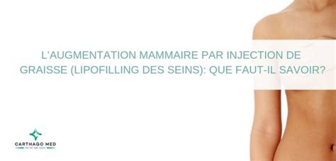 Lipostructure Ou Lipofilling Seins Ce Qu Il Faut Savoir Sur Le