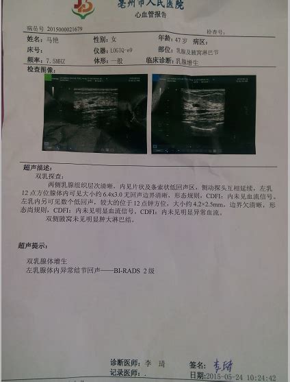 乳腺b超怎么做 乳腺b超和彩超的区别 随意云