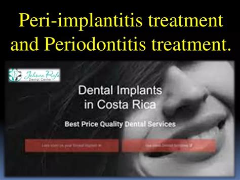 Ppt Peri Implantitis Treatment And Periodontitis Treatment