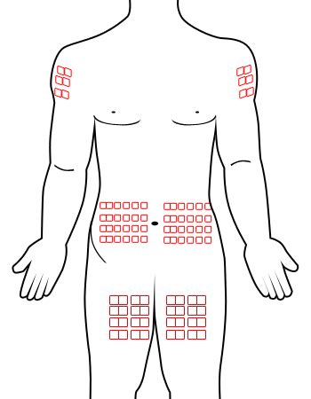 Subcutaneous Injection Sites Rotation Chart