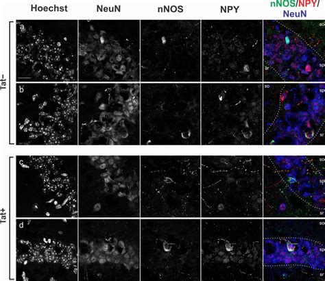 Subcellular Localization Of Neuronal Nitric Oxide Synthase Nnos And Download Scientific