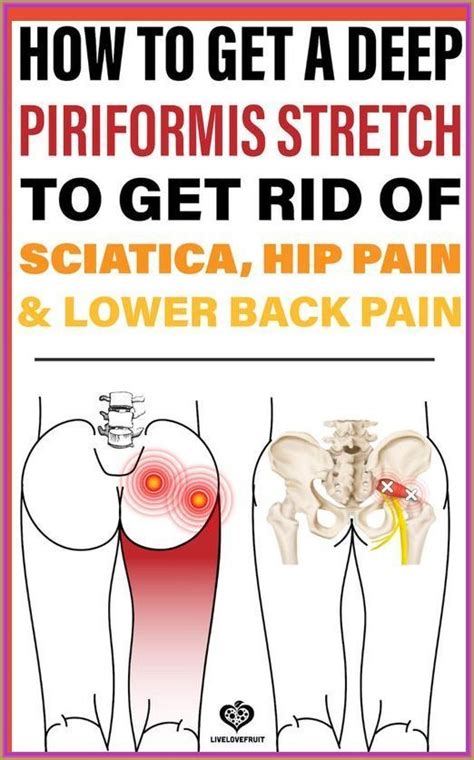 Get rid of sciatica hip lower back pain – Artofit