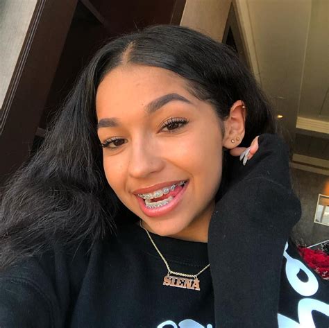 Iena Rodarte 💛 Mixed 👅 On Instagram “😆💋” Cute Braces Brace