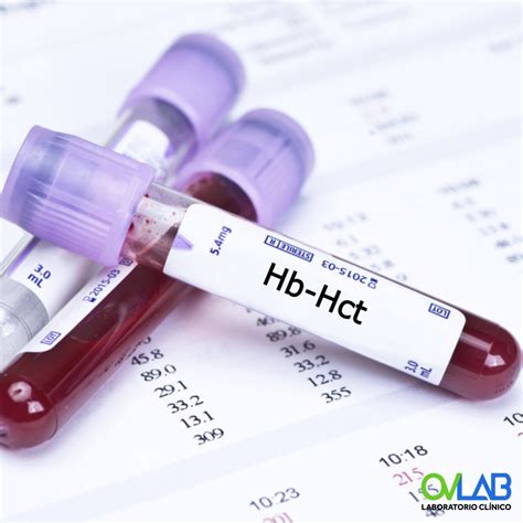 Conozca Los Valores Normales De La Hemoglobina Revista PEM 58 OFF