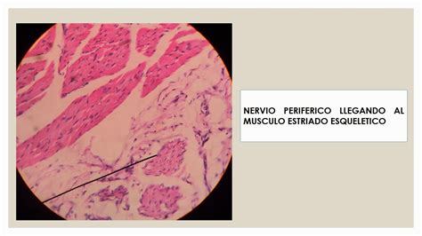 TEMAS MÉDICOS: HISTOLOGÍA TEJIDO NERVIOSO