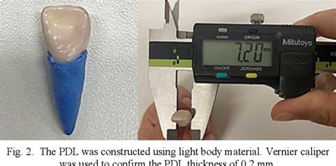 Figure From Bone Strain Measurement In A Maxillary Incisor Subjected