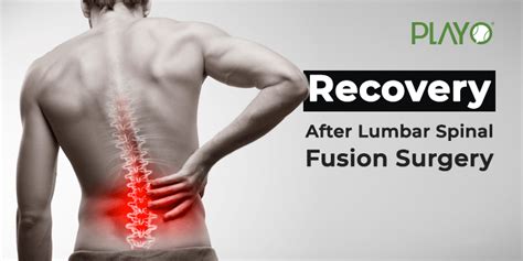 After A Lumbar Spinal Fusion Surgery Here Is How You Recover Playo