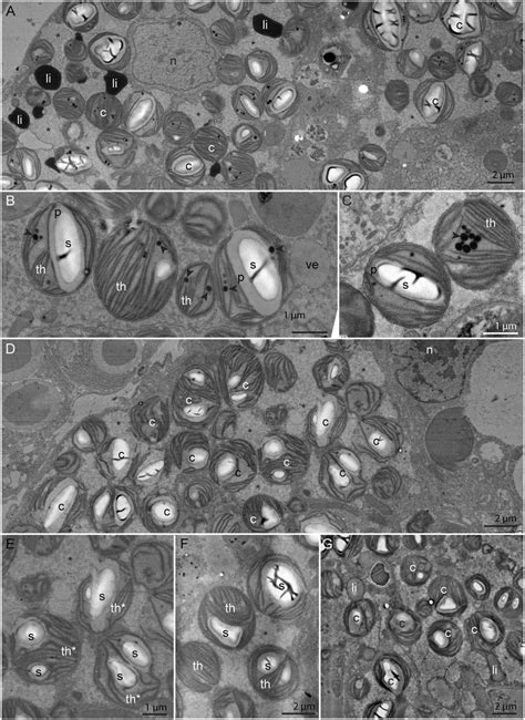 Transmission Electron Microscopy Tem Micrographs Of The Download