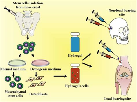 Frontiers Recent Advances Of Chitosan Based Injectable 56 OFF