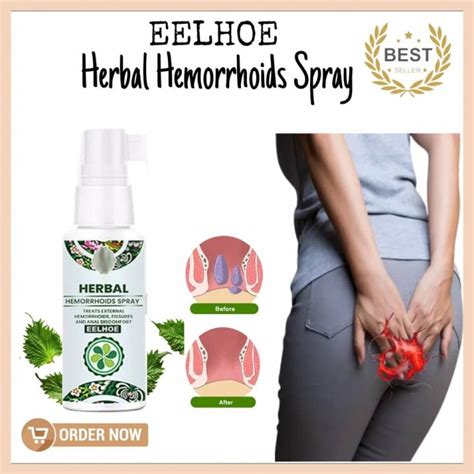 100 Effective EELHOE YUNNAN Natural Herbal Hemorrhoids Spray Original