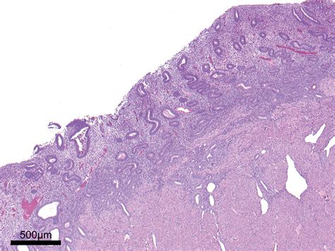 HE Slide Proliferative Phase Age30 Endometrium 3D Data