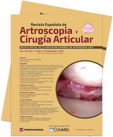 Luxación Recidivante Anteroinferior Del Hombro Artículos