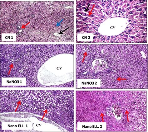 Photomicrograph Of Liver Stained With Hematoxylin And Eosincn1 Download Scientific Diagram