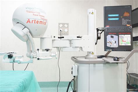 Guia Operatoria Biopsia Por Fusión Con Robot Artemis Ispro Barcelona