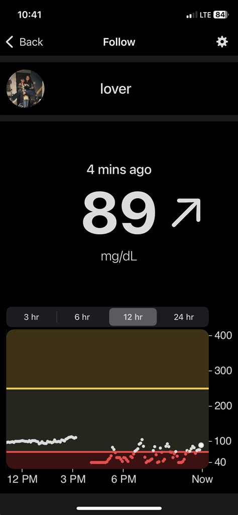 Dexcom g7 : r/dexcom