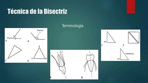 Tecnicas Radiograficas Intrabucales Ppt