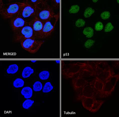 S Rmab® P53 Recombinant Rabbit Mab Sdt R118p04637斯达特公司官网