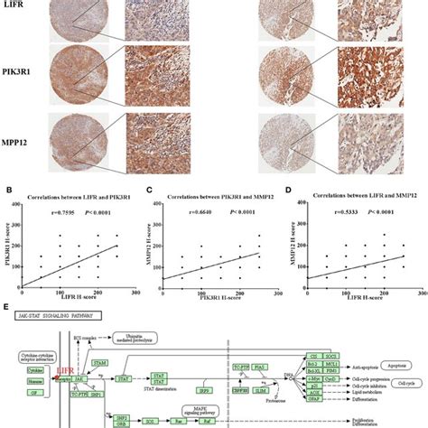 Expression And Regulation Relation Among Lifr Pik3r1 And Mmp12 In Gbc