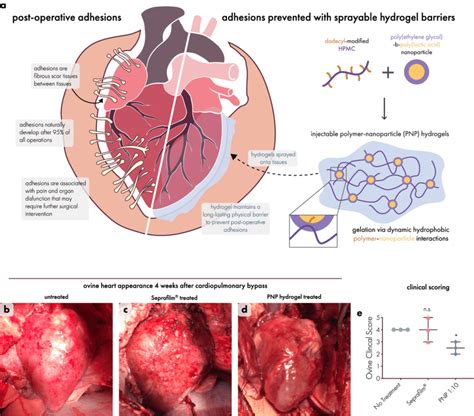 (a) Schematic representation of postoperative adhesions, fibrous bands ...