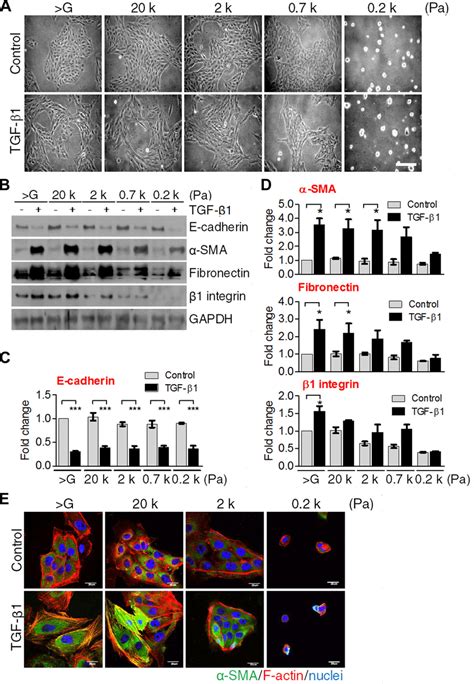 Soft Matrix Stunts Transforming Growth Factor Tgf 1 Induced Download Scientific Diagram