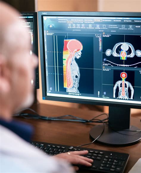 CT Simulation Radiotherapy Centers Of Kentuckiana