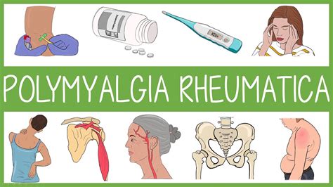 Polymyalgia Rheumatica Youtube