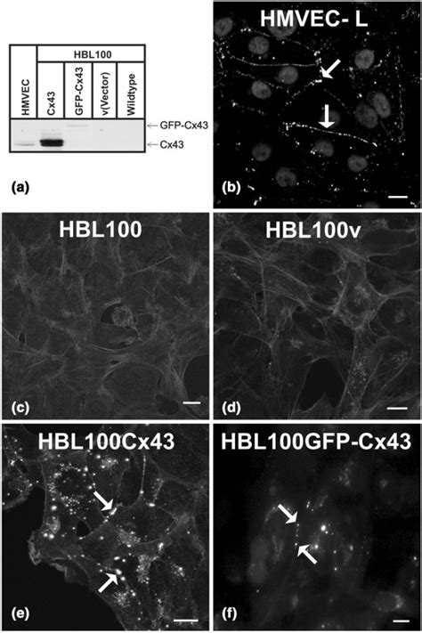 Human Microvascular Endothelial Cells Hmvecs Cambrex Bioz