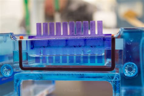 Gel Electrophoresis – Cedar Writes