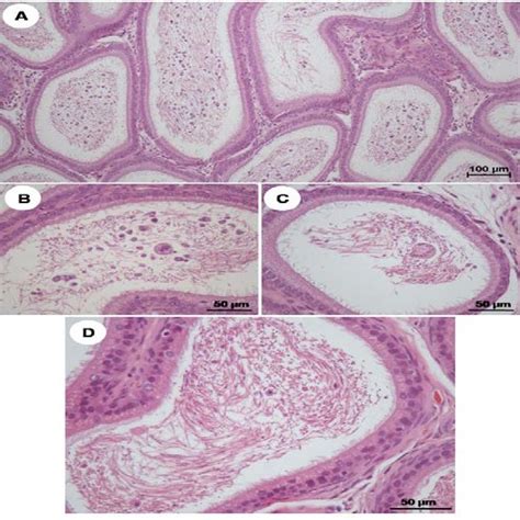 Representative Immuno Western Blotting Of Androgen Receptor In