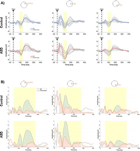 A Single And Paired Pulse TMS EEG Investigation Of The N100 And Long