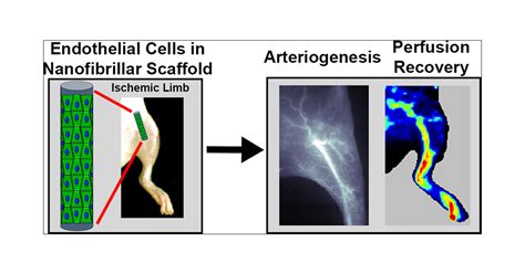 Aligned Braided Nanofibrillar Scaffold With Endothelial Cells Enhances