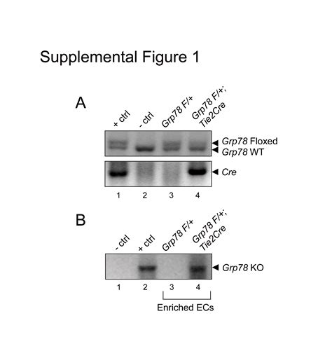 A Critical Role For GRP78 BiP In The Tumor Microenvironment For