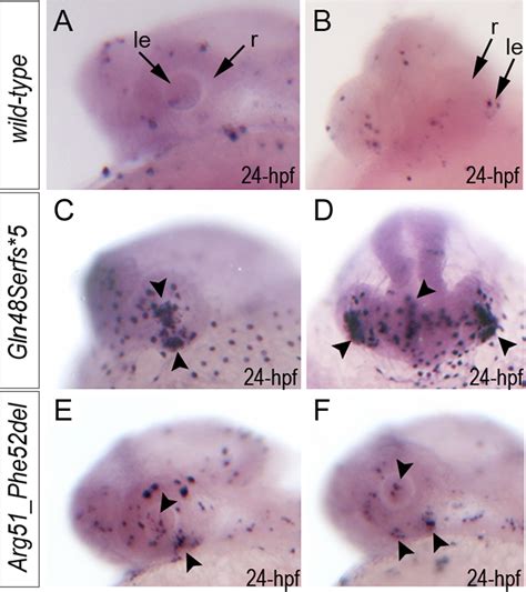 Summary Of TUNEL Assays In Zebrafish Wild Type And Mab21l2 Mutant