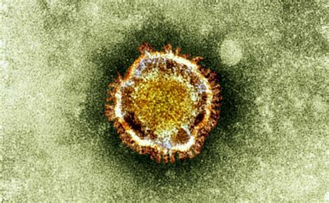 Coronavirus La Oms Asegura Que El Origen Del Covid Es Natural