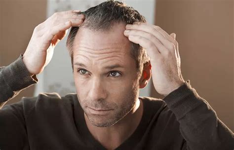 Finasteride For Hair Loss Dose Results And Side Effects