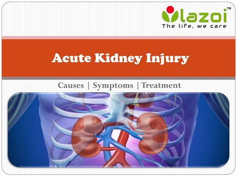 Ppt Acute Kidney Injury Powerpoint Presentation Free Download Id