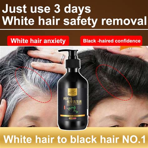 Shampoo for Black Hair 300ml Promotes hair growth, prevents hair loss ...