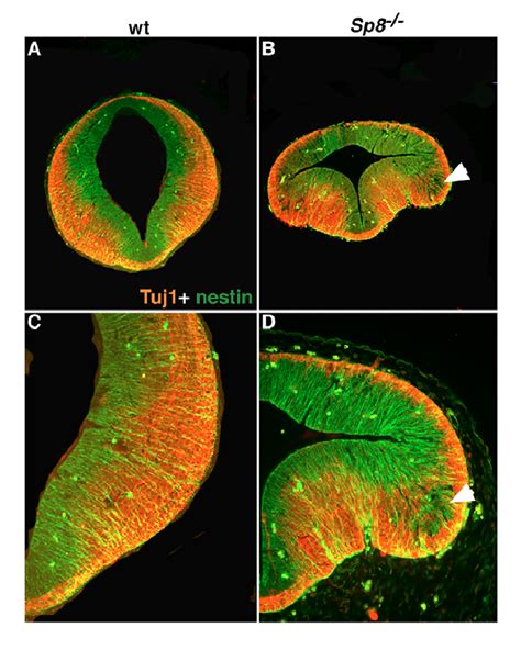 Cell Differentiation May Be Delayed At E In The Absence Of Sp