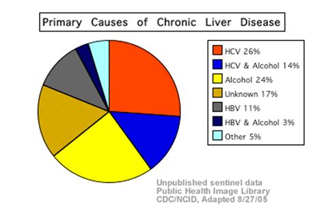 From fatty food to a sedentary lifestyle, all can contribute to liver ...