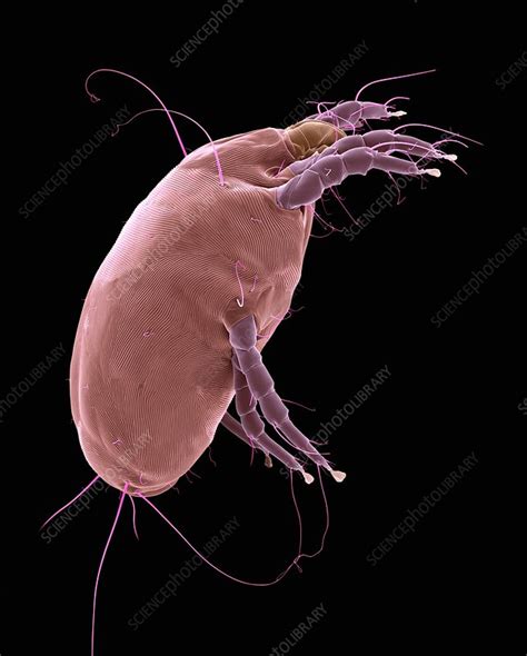 Dust Mite Dermatophagoides Pteronyssinus SEM Stock Image C032