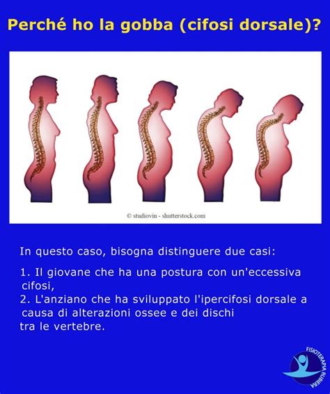 6 Esercizi Per La Postura Fisioterapia Rubiera