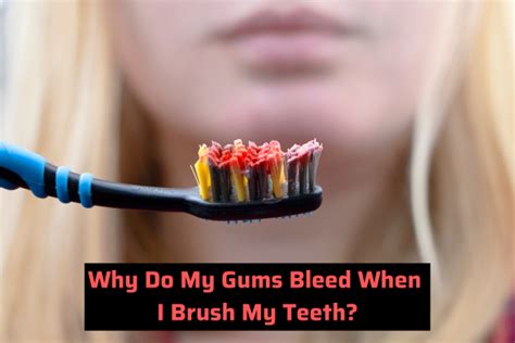 Why Do My Gums Bleed When I Brush My Teeth