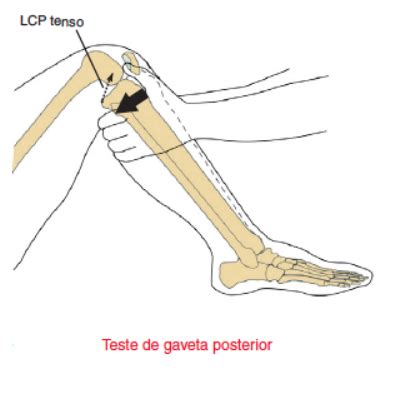 Ligamento Cruzado Posterior LCP E Fisio