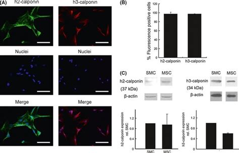 Expression And Intracellular Localization Of H2 Calponin And